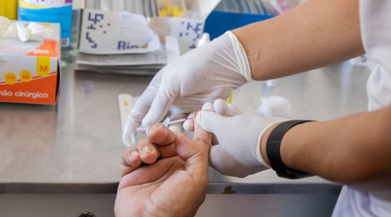 Teste rápido para hepatites é intensificado em Manaus
