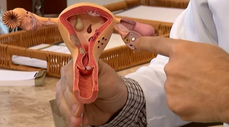 CNPq vai financiar estudos sobre saúde menstrual e endometriose