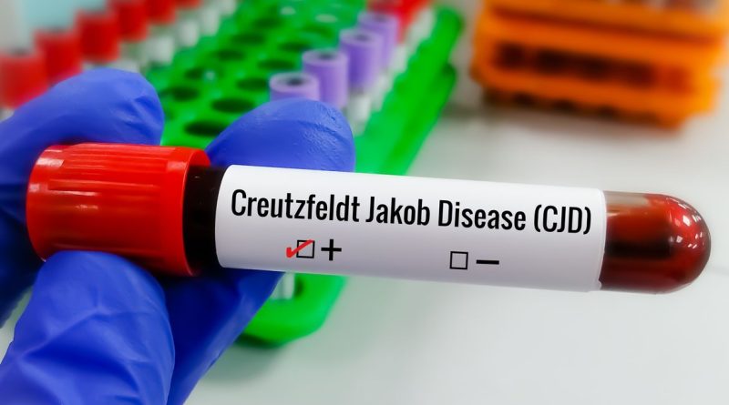 Creutzfeldt-Jakob: entenda a doença rara de Lito Sousa